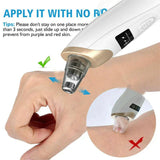 5-In-1 Rechargeable Suction Acne and Blackhead Remover for Men and Women