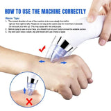 5-In-1 Rechargeable Suction Acne and Blackhead Remover for Men and Women